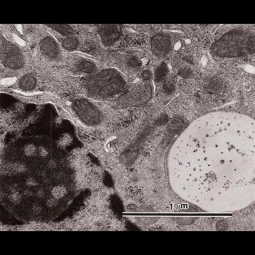  NCBI Organism:Cavia porcellus; Cell Types:Leydig cell Cell Components:nucleolus, vacuole; Biological process:organelle organization