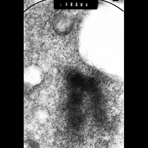  NCBI Organism:Cricetulus griseus; Cell Types:epithelial cell Cell Components:nuclear chromosome, kinetochore; Biological process:chromosome organization, mitosis, mitotic metaphase;