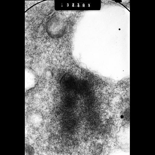  NCBI Organism:Cricetulus griseus; Cell Types:epithelial cell Cell Components:nuclear chromosome, kinetochore; Biological process:chromosome organization, mitosis, mitotic metaphase;