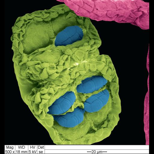  NCBI Organism:Acacia dealbata; Cell Components:pollen coat