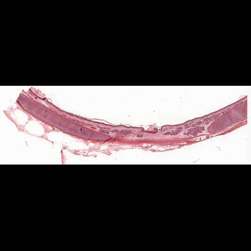  NCBI Organism:Homo sapiens; Cell Types:ciliated epithelial cell Cell Components:hyaline layer