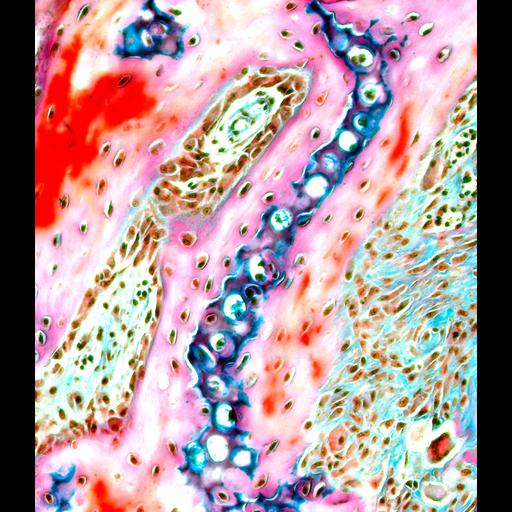  Cell Types:osteoblast Biological process:ossification