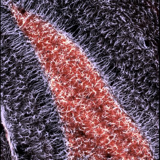  NCBI Organism:Mus musculus; Cell Types:astrocyte Cell Components:cell projection Biological process:glial cell proliferation