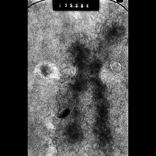  NCBI Organism:Cricetulus griseus; Cell Types:epithelial cell Cell Components:nuclear chromosome, kinetochore; Biological process:chromosome organization, mitosis, mitotic metaphase;