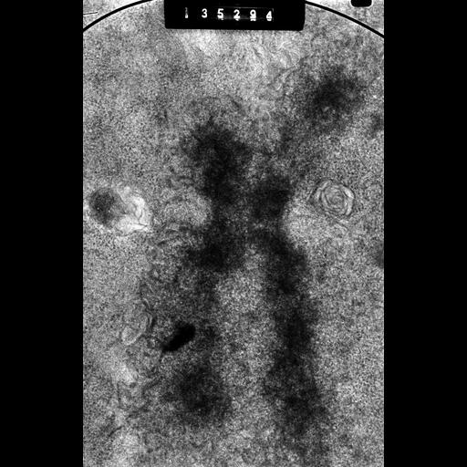  NCBI Organism:Cricetulus griseus; Cell Types:epithelial cell Cell Components:nuclear chromosome, kinetochore; Biological process:chromosome organization, mitosis, mitotic metaphase;