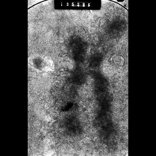  NCBI Organism:Cricetulus griseus; Cell Types:epithelial cell Cell Components:nuclear chromosome, kinetochore; Biological process:chromosome organization, mitosis, mitotic metaphase;