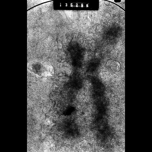  NCBI Organism:Cricetulus griseus; Cell Types:epithelial cell Cell Components:nuclear chromosome, kinetochore; Biological process:chromosome organization, mitosis, mitotic metaphase;