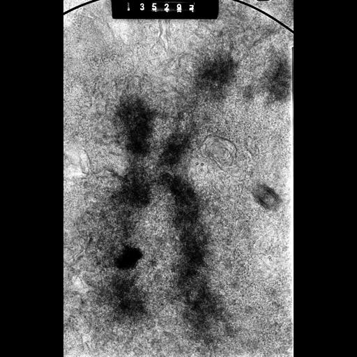  NCBI Organism:Cricetulus griseus; Cell Types:epithelial cell Cell Components:nuclear chromosome, kinetochore; Biological process:chromosome organization, mitosis, mitotic metaphase;