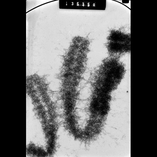  NCBI Organism:Cricetulus griseus; Cell Types:, epithelial cell; Cell Components:nuclear chromosome Biological process:chromosome organization, mitotic metaphase, mitosis;