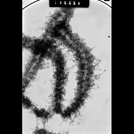  NCBI Organism:Cricetulus griseus; Cell Types:, epithelial cell; Cell Components:nuclear chromosome Biological process:chromosome organization, mitotic metaphase, mitosis;