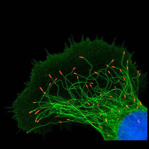  NCBI Organism:Xenopus; Cell Types:melanocyte Cell Components:microtubule cytoskeleton, nucleus; Biological process:microtubule polymerization, regulation of microtubule polymerization;