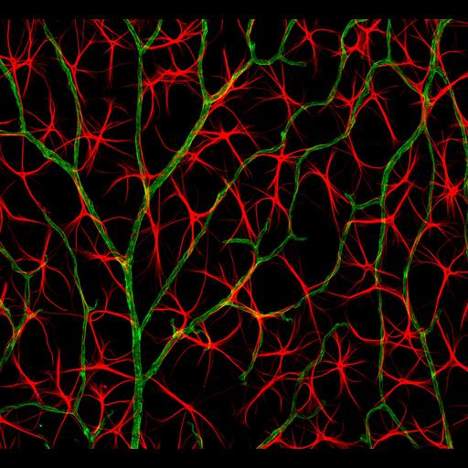  NCBI Organism:Mus musculus; Cell Types:astrocyte Cell Components:cell projection