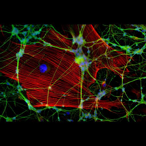  Cell Types:glial cell, neuron; Cell Components:actin cytoskeleton, nucleus, neuron projection, neuronal cell body;