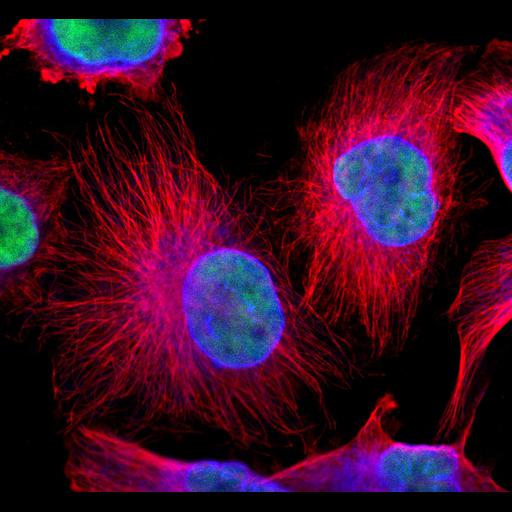  NCBI Organism:Homo sapiens; Cell Components:nuclear membrane, microtubule cytoskeleton, endoplasmic reticulum; Biological process:organelle organization, cytoskeleton organization;