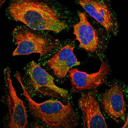  NCBI Organism:Homo sapiens; Cell Components:focal adhesion, cytoplasm, nucleus, microtubule cytoskeleton; Biological process:organelle organization, cytoskeleton organization;