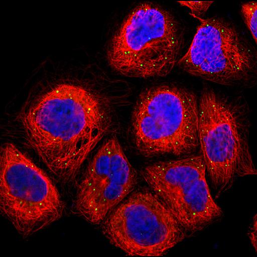  NCBI Organism:Homo sapiens; Cell Components:vesicle, nucleus, microtubule cytoskeleton; Biological process:organelle organization, cytoskeleton organization;