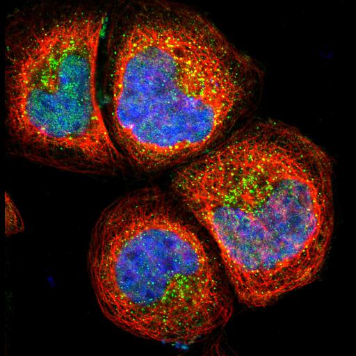  NCBI Organism:Homo sapiens; Cell Components:vesicle, nucleus, cytoplasm, microtubule cytoskeleton, plasma membrane; Biological process:organelle organization, cytoskeleton organization;