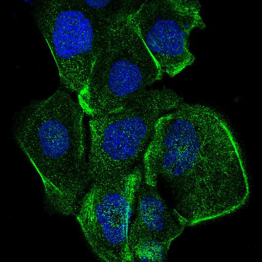  NCBI Organism:Homo sapiens; Cell Components:actin cytoskeleton, nucleus; Biological process:organelle organization, cytoskeleton organization;