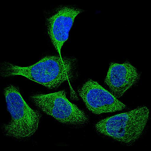  NCBI Organism:Homo sapiens; Cell Components:microtubule cytoskeleton, nucleus, cytoplasm; Biological process:organelle organization, cytoskeleton organization;