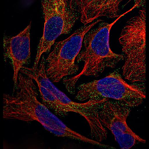  NCBI Organism:Homo sapiens; Cell Components:vesicle, nucleus, microtubule cytoskeleton; Biological process:organelle organization, cytoskeleton organization;