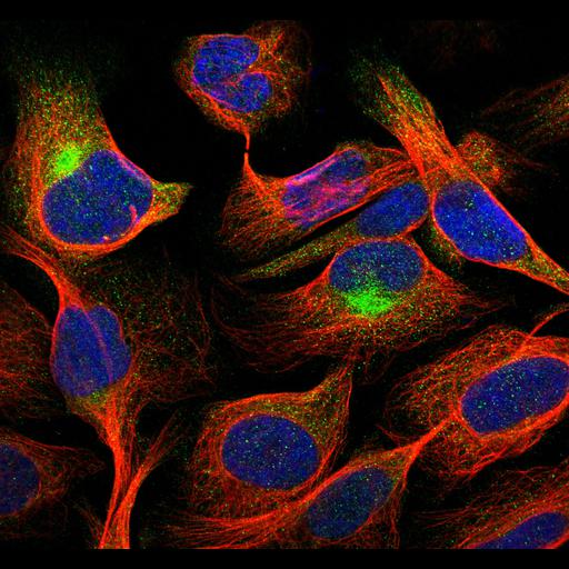  NCBI Organism:Homo sapiens; Cell Components:aggresome, microtubule cytoskeleton, nucleus; Biological process:organelle organization, cytoskeleton organization;