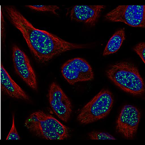  NCBI Organism:Homo sapiens; Cell Components:nucleus, microtubule cytoskeleton; Biological process:organelle organization, cytoskeleton organization;