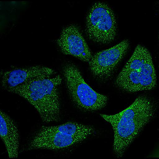  NCBI Organism:Homo sapiens; Cell Components:vesicle, centrosome, nucleus; Biological process:organelle organization, cytoskeleton organization;