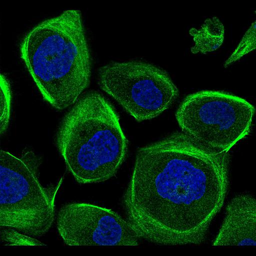  NCBI Organism:Homo sapiens; Cell Components:intermediate filament, nucleus; Biological process:organelle organization, cytoskeleton organization;