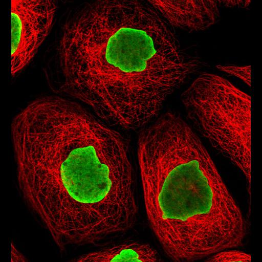  NCBI Organism:Homo sapiens; Cell Components:nucleus, microtubule cytoskeleton; Biological process:organelle organization, cytoskeleton organization;