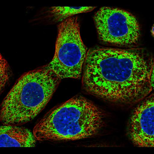  NCBI Organism:Homo sapiens; Cell Components:endoplasmic reticulum, nucleus, microtubule cytoskeleton; Biological process:organelle organization, cytoskeleton organization;