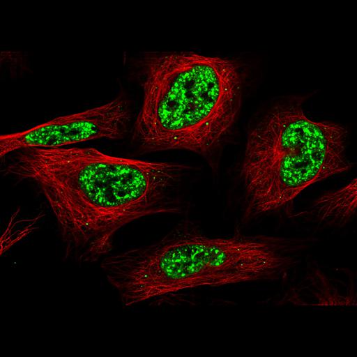  NCBI Organism:Homo sapiens; Cell Components:nucleus, microtubule cytoskeleton; Biological process:organelle organization, cytoskeleton organization;