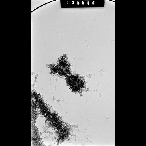  NCBI Organism:Cricetulus griseus; Cell Components:nuclear chromosome Biological process:mitosis, mitotic metaphase, chromosome organization;