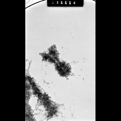  NCBI Organism:Cricetulus griseus; Cell Components:nuclear chromosome Biological process:mitosis, mitotic metaphase, chromosome organization;