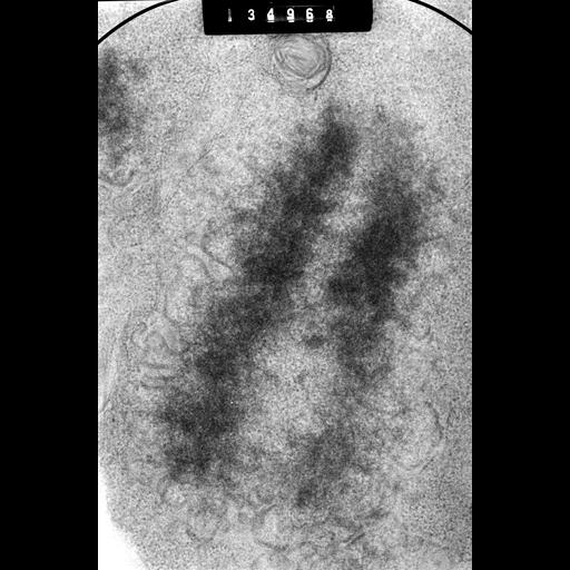  NCBI Organism:Cricetulus griseus; Cell Components:nuclear chromosome Biological process:mitosis, mitotic metaphase, chromosome organization;