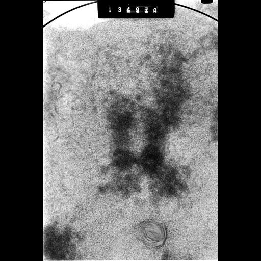  NCBI Organism:Cricetulus griseus; Cell Components:nuclear chromosome Biological process:mitosis, mitotic metaphase, chromosome organization;