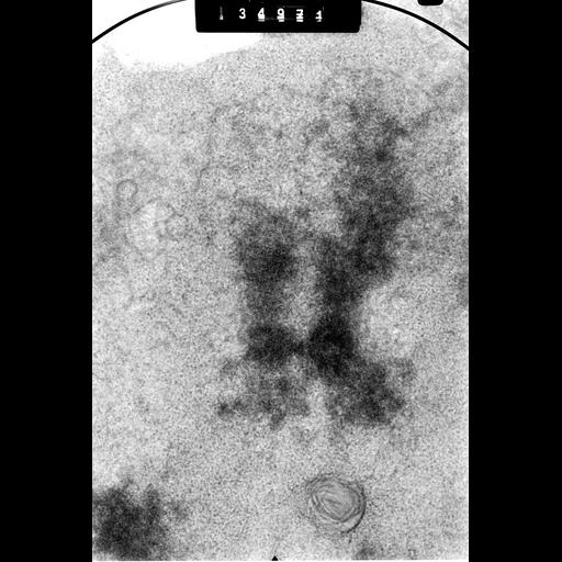  NCBI Organism:Cricetulus griseus; Cell Components:nuclear chromosome Biological process:mitosis, mitotic metaphase, chromosome organization;