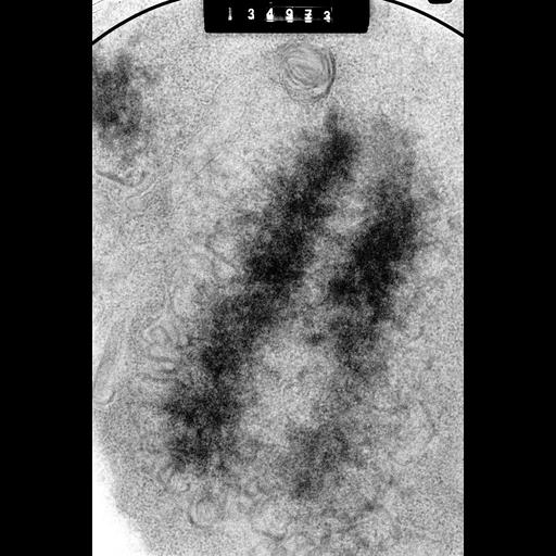  NCBI Organism:Cricetulus griseus; Cell Components:nuclear chromosome Biological process:mitosis, mitotic metaphase, chromosome organization;