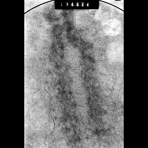  NCBI Organism:Cricetulus griseus; Cell Components:nuclear chromosome Biological process:mitosis, mitotic metaphase, chromosome organization;