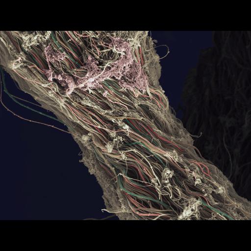  NCBI Organism:Homo sapiens; Cell Components:fibrillar collagen