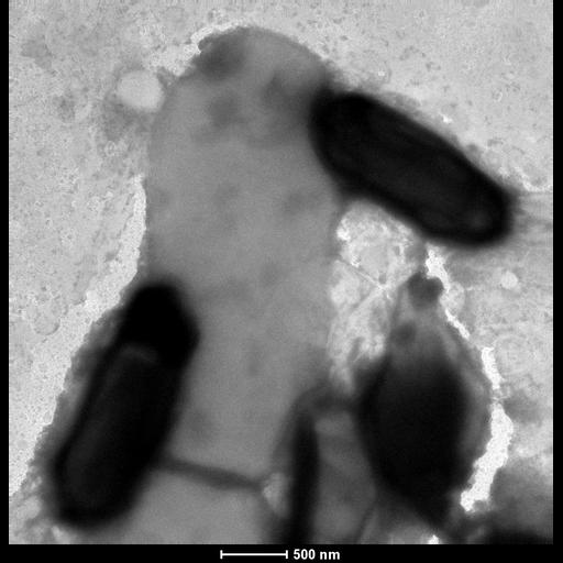  NCBI Organism:Bacillus thuringiensis; Cell Components:cell surface