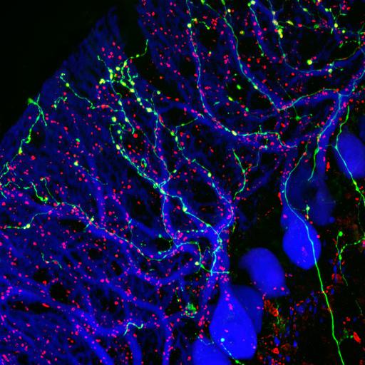  NCBI Organism:Mus musculus; Cell Types:Purkinje cell, ; Cell Components:, neuron projection membrane, neuronal cell body;