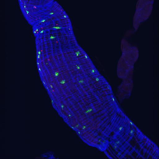  NCBI Organism:Drosophila melanogaster; Cell Types:endocrine cell, muscle cell; Cell Components:actin filament Biological process:endocrine hormone secretion