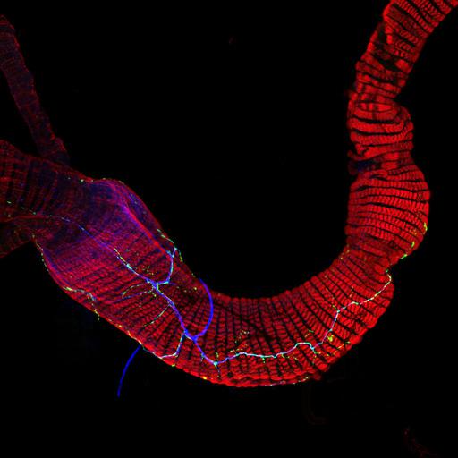  NCBI Organism:Drosophila melanogaster; Cell Types:muscle cell, neuron; Cell Components:actin filament, , neuron projection, ;