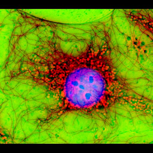  Cell Types:fibroblast Cell Components:microtubule cytoskeleton, nucleus; Biological process:cytoskeleton organization