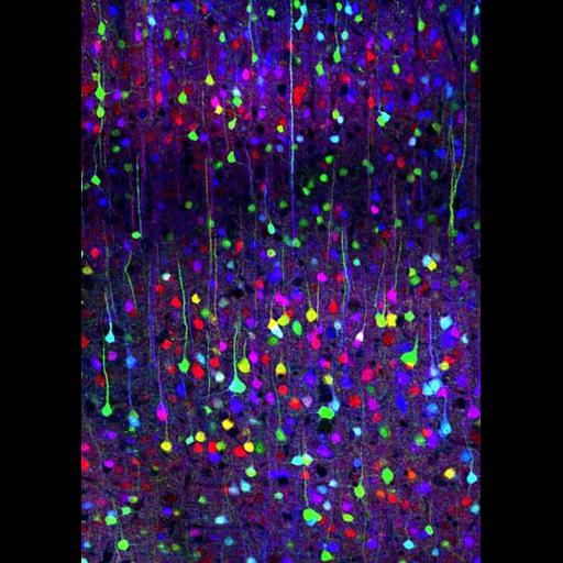  NCBI Organism:Mus musculus; Cell Components:neuron projection Biological process:neuron projection morphogenesis