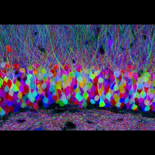  NCBI Organism:Mus musculus; Cell Types:neuron Cell Components:neuron projection Biological process:neuron projection morphogenesis