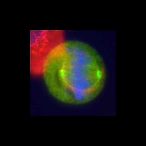  NCBI Organism:Homo sapiens; Cell Types:epithelial cell Cell Components:condensed chromosome, mitotic spindle; Biological process:nuclear division