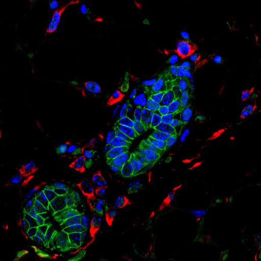  NCBI Organism:Mus musculus; Cell Types:mammary epithelial cell Cell Components:nucleus, intermediate filament, cell-cell junction; Biological process:lactation