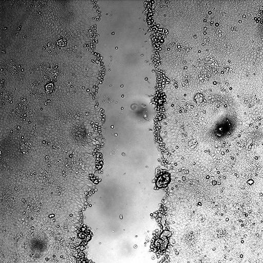  NCBI Organism:Canis lupus familiaris; Cell Types:kidney epithelial cell Biological process:wound healing, spreading of epidermal cells, ;