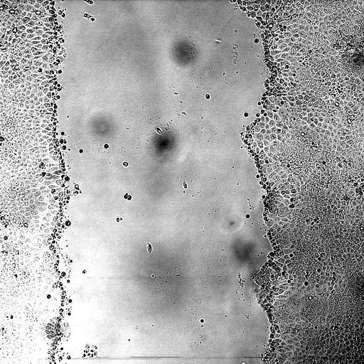  NCBI Organism:Canis lupus familiaris; Cell Types:kidney epithelial cell Biological process:wound healing, spreading of epidermal cells, ;